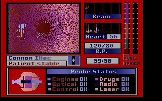 Pantallazo de Laser Surgeon: The Microscopic Mission para PC