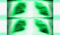 Pantallazo nº 152775 de LifeSigns: Hospital Affairs (240 x 384)